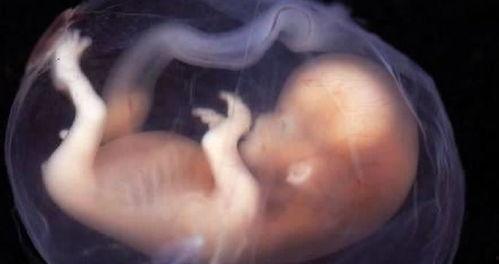 吃瓜胎儿流产事件视频,一场网络暴力引发的悲剧